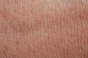 Cum ajută salinoterapia pielii: Haloterapia face ca pielea să fie mai rezistentă în fața bacteriilor, Reduce inflamația și edemul pielii.